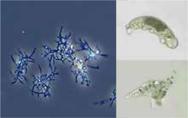 写真１：放線菌（左）、クマムシ(右上)、アメーバ(右下)