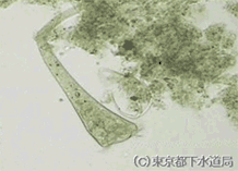 ステントルの様子